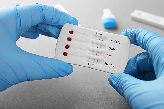 Nákazy AIDS přibývá i mezi heterosexuály. O viru ve svém těle nevědí, mnozí umírají