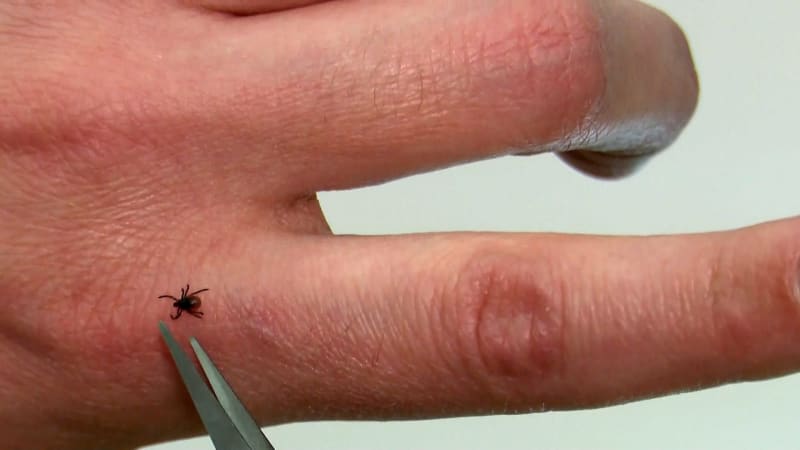 Rekordní počet případů boreliózy v Česku: Lékaři hlásí znepokojivá data, často se týká houbařů